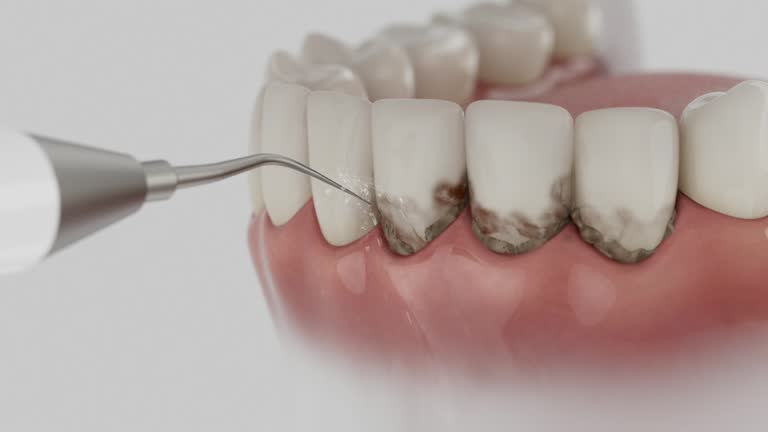 Trusted Teeth Cleaning And Checkup service in Lathrop, MO - Dentist Open Now